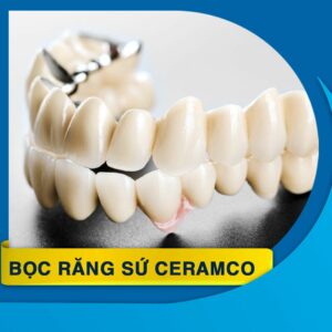 boc rang su ceramco