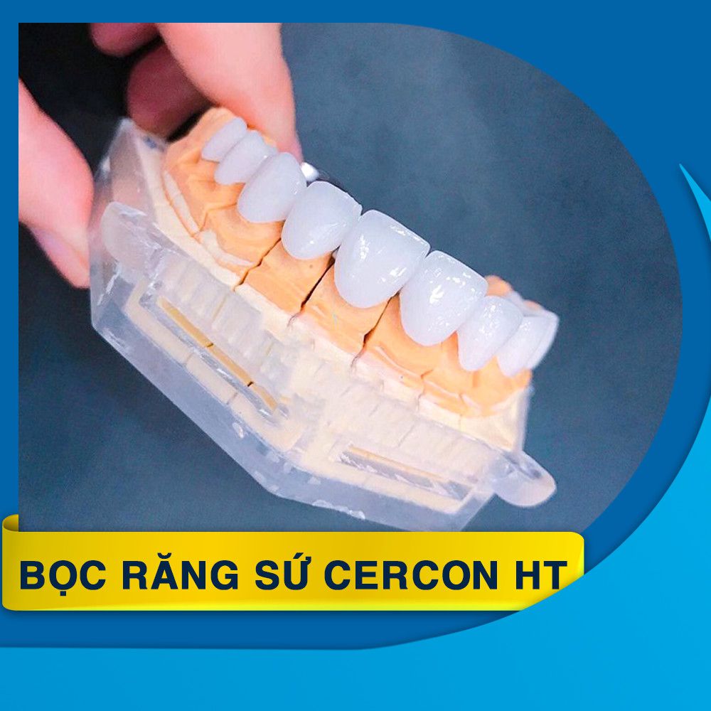 boc rang su cercon HT